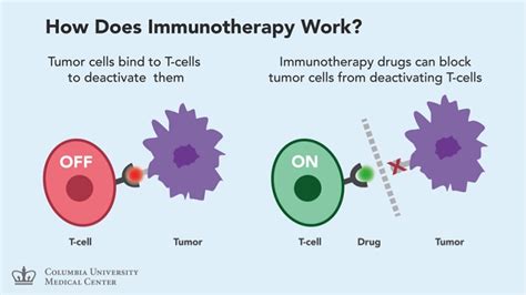 fda approved immunotherapy for melanoma